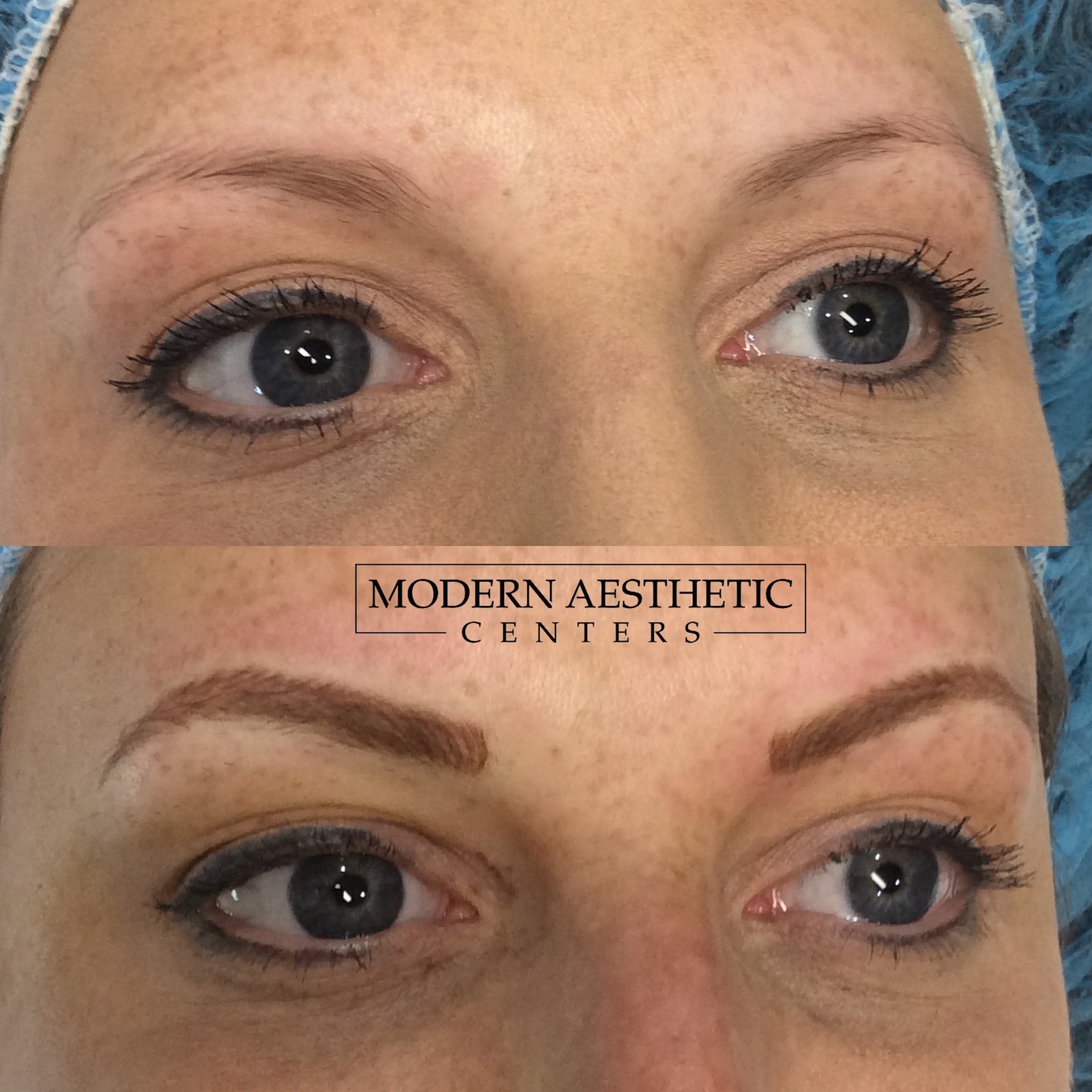 Permanent Makeup Gallery Before & After Image